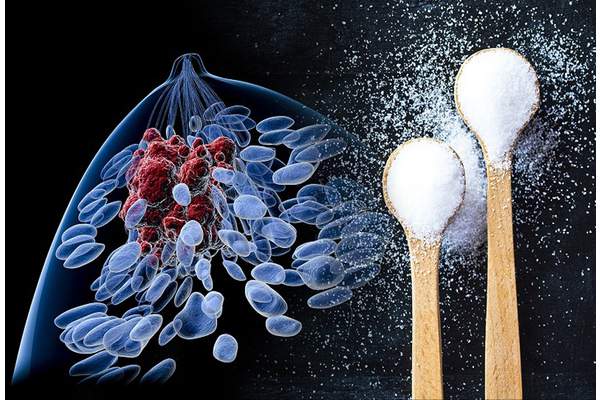 Ученые обнаружили связь сахара и быстрого развития рака в организме