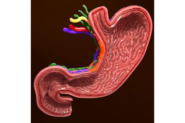 Секреторная функция желудка у больных с тяжелым течением язвенной болезни двенадцатиперстной кишки