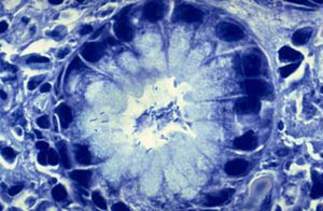 Инфицирование Helicobacter pylori: небольшая, изогнутая в спираль палочковидная бактерия основывается в поверхностной эпителиальной слизи (микропрепарат, окраска метиленовым синим).