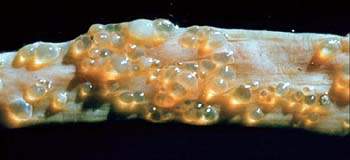 Интестинальный кистозный пневматоз: газовые пузыри различного размера в стенке кишки (макропрепарат).