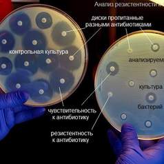 Ученые определили как остановить развитие резистентности к антибиотикам