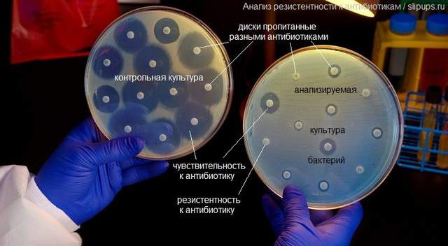 Ученые определили как остановить развитие резистентности к антибиотикам