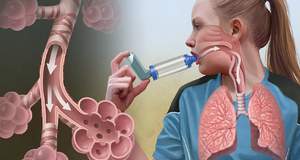 Хотите предупредить астму? Оздоровите Ваш кишечник!