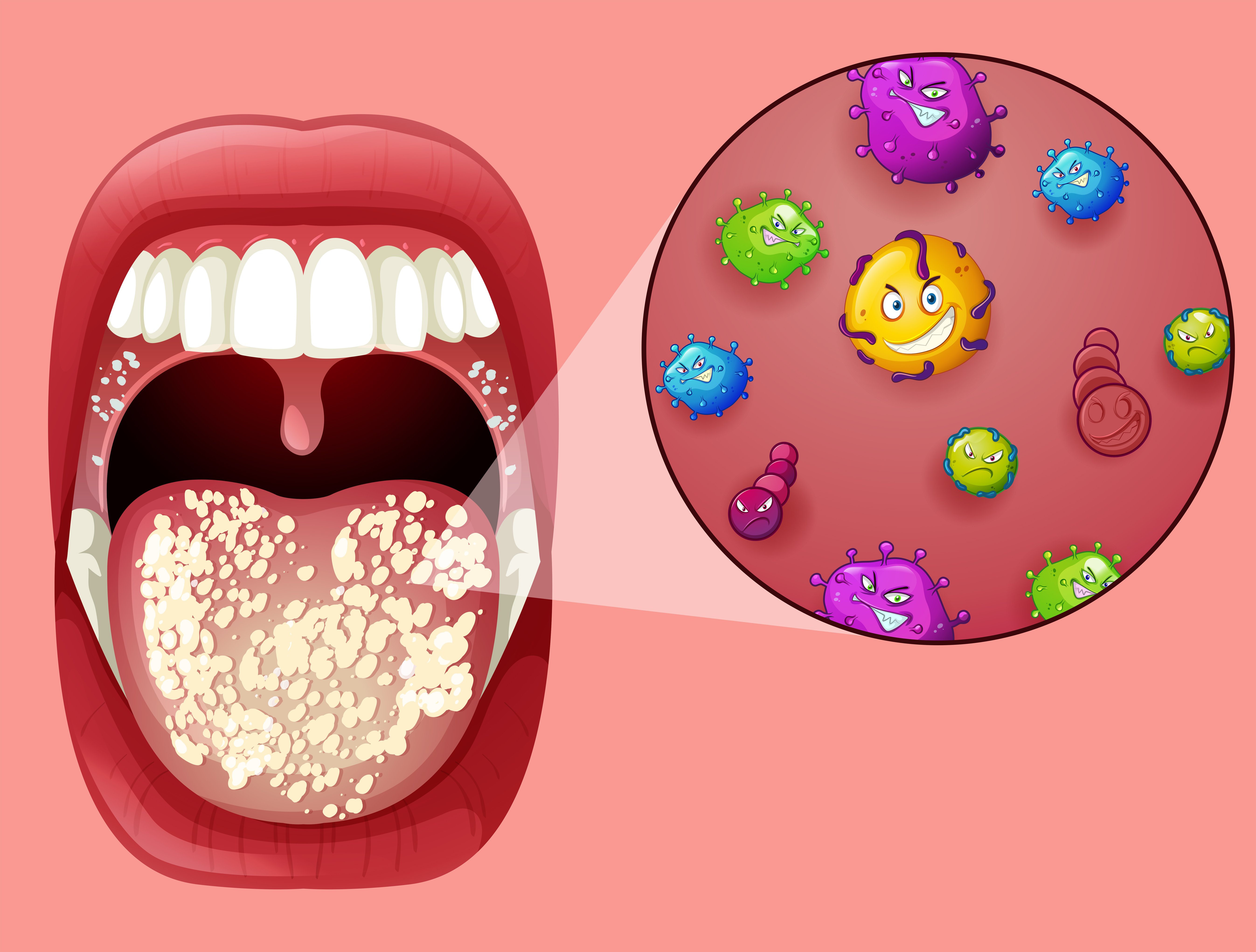 Микробная Флора полости рта